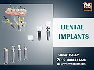 Best Dental implant clinic in Kukatpally & KPHB - FMS DENTAL
