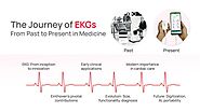 The Journey of EKGs: From Past to Present in Medicine