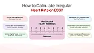 How to Calculate Irregular Heart Rate on ECG?