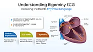 Bigeminy ECG: Meaning, Symptoms and Treatment