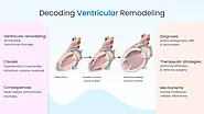 Decoding Ventricular Remodeling