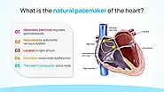 What is the Natural Pacemaker of the Heart?