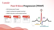 Poor R Wave Progression (PRWP)