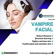 Revolutionize Your Skin: Acne Treatment in Mohali | Esthetica Cosmetology