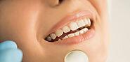 Teeth Whitening Services in Kitchener - King Street Dental Centre