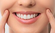 How to Choose the Best Teeth Whitening Dentist in Riverside, CA