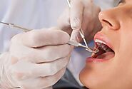 Local Dentist in Riverside: Tips for Choosing the Right Dental Care Provider