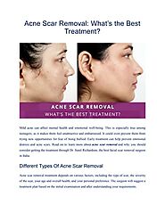 Acne Scar Removal – Treatment Types, Cost, Recovery