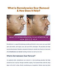 Dermabrasion Scar Removal: What, How, Cost & Recovery
