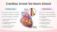 Cardiac Arrest Vs Heart Attack