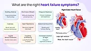 What are the Right Heart Failure Symptoms?