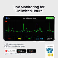 Spandan 4.0: Monitor your Heart Live for Unlimited Hours