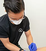 Acupuncture and IMS / Dry Needling | Launch Rehab
