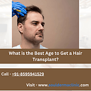 What is the Best Age to Get a Hair Transplant?