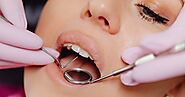 How to Maintain Dental Implants Melbourne ? - Telent Duniya