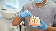 Which of These 3 Dental Implants Is Best for You?