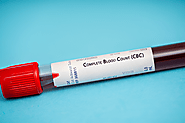 Complete Blood Count (CBC) Test: An Essential Diagnostic Tool | by Lab Provider | Mar, 2024 | Medium
