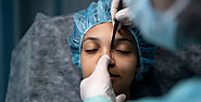 Rhinoplasty Surgery In Delhi