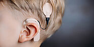 Cochlear Implant Surgery In Delhi