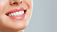 11 Benefits of Teeth Whitening by Professionals