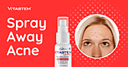 Spray Away Acne Fast with Vitastem Ultra: A Topical Antibiotic Like Nothing Else