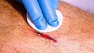 Infected Cuts: How to Identify & Treat Them Fast to Prevent Health Risks and Complications - Healthinfo.biz