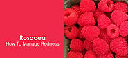 How To Manage Rosacea