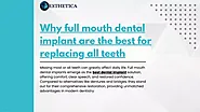 PPT - Why full mouth dental implant are the best for replacing all teeth PowerPoint Presentation - ID:13049886
