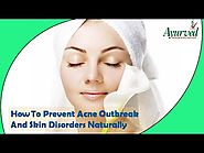 How To Prevent Acne Outbreak And Skin Disorders Naturally?