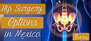 Best Destinations for Hip Surgery in Mexico
