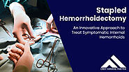 Effective Relief from Internal Hemorrhoids with Crest Surgical