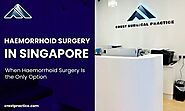 Advanced Haemorrhoid Surgery Solutions in Singapore