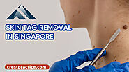 Singapore’s Leading Skin Surgery Clinics