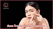 Best Acne Treatment in Bangalore | Charma Clinic