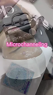 LETS MICROCHANNEL THE SKIN BACK TO LIFE✨ on Vimeo