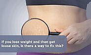 If You Lose Weight And Then Get Loose Skin, Is There A Way To Fix This?