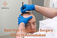 Best Hair Transplant Surgery Clinic in Ahmedabad