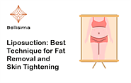 Liposuction: Best Technique for Fat Removal and Skin Tightening