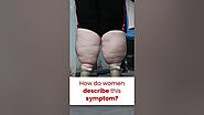 How Did You Describe Your Legs Before You Knew It Was Lipedema?