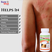 Urticaria -Hives-Weals-Welts or Nettle Rash-No More-Get Rid of Cetrizin – Sure Shot Herbals