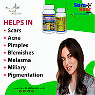 Dr.Garg's M.D. - Looks Samrat Tablets (100 Pcs) For Acne And Pimple, Scar, Pigmentation, Blemishes, Melasma, Miliary