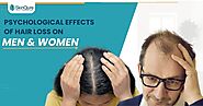 Psychological Effects of Hair Loss on Men and Women