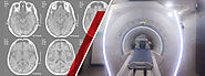 MRI Scan in Kandivali | Diagnostic Lab | Vcare.