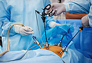 Benefits And Risks Of Laparoscopic Surgery | Private Hospitals in Solan Blogs