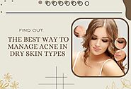 Find Out The Best Way To Manage Acne In Dry Skin Types
