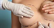 Can You Get a Breast Reduction Twice?