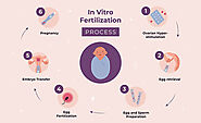 In-Vitro Fertilization (IVF) - Dr. Rhythm Gupta - Excel IVF