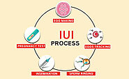 What is IUI (Intrauterine insemination) Treatment?