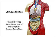 A Holistic Ayurvedic Approach to Chylous Ascites - Causes and Remedies