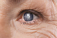 Is Glaucoma Disease Infected Lifelong?